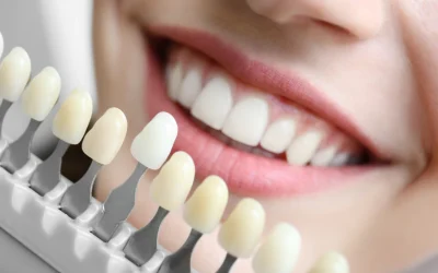 Safe, Lasting Smiles: The Benefits of Professional Teeth Whitening in North Ridgeville, OH